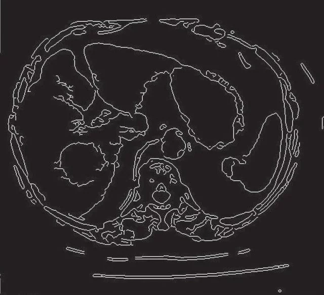 edge canny detection image segmentation technique